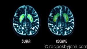 fed-up-sugar-cocaine-brain-scan-620